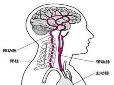 腦出血“征兆”大點兵!