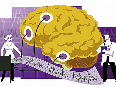 腦卒中不是&ldquo;老年病&rdquo;預防腦卒中從年輕人開始