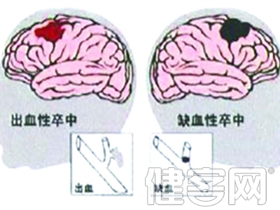 過年喝酒打牌別沖動 警惕&ldquo;腦卒中&rdquo;