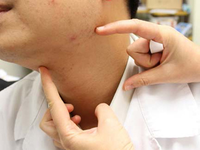 七旬大娘突然&ldquo;癡呆&rdquo;&ldquo;垃圾&rdquo;堵頸動脈近90%