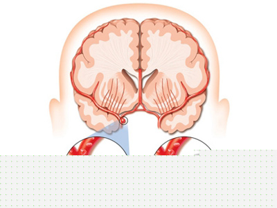 心血管防護措施