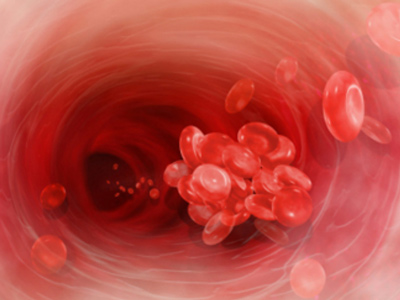 &ldquo;世界血栓日&rdquo;來了，血栓是最隱蔽的殺手