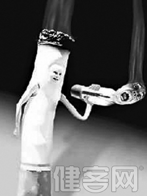 老年高血壓的特點