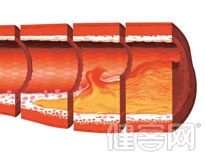 別再大意啦！心腦血管有&ldquo;十怕&rdquo;