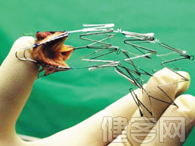 心髒支架手術方案有望&ldquo;私人定制&rdquo;