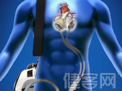 忽視10年的高血壓險致命 &ldquo;人工心髒&rdquo;助脫險