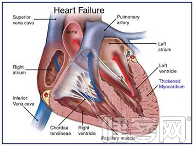 冠心病外科手術能否進行