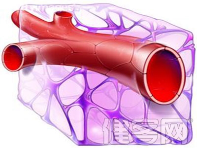 心髒&ldquo;搭橋&rdquo;適合六類人