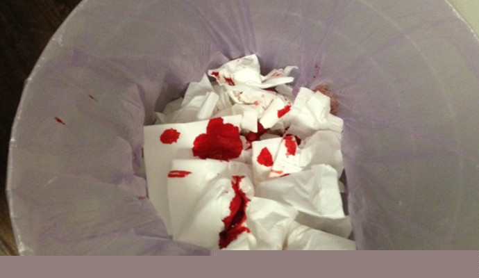 【高血壓】存在哪些常見表現？