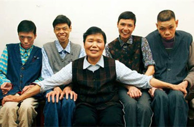 先天性心髒病，你知道原因嗎？