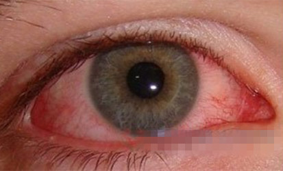 &ldquo;心髒病&rdquo;不能去游泳，你了解多少？