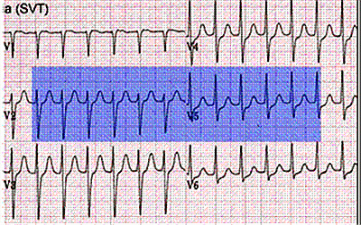 心髒不好，可能源於這些