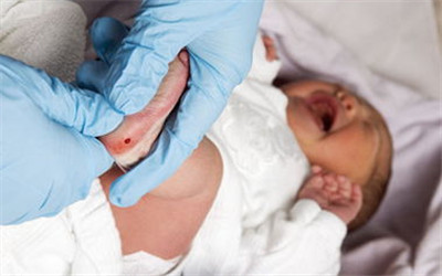 高脂血症不再是胖子&lsquo;特有&rsquo;