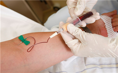 高脂血症不再是胖子&lsquo;特有&rsquo;