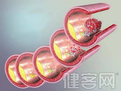 吃了防血栓藥農婦變&ldquo;玻璃人&rdquo;