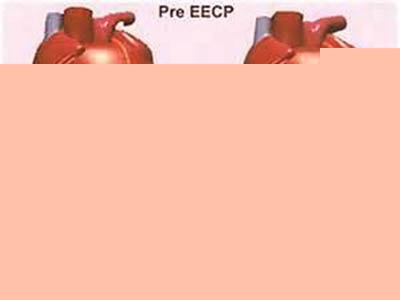 心血管堵塞的症狀?