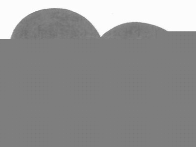 心肌缺血藥物治療