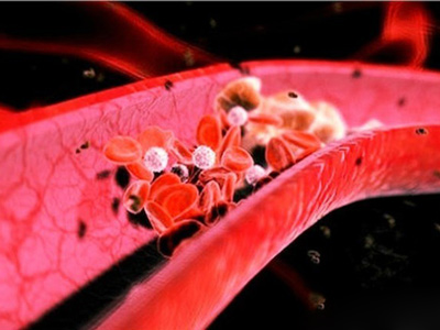 過節血管表示&ldquo;壓力&rdquo;很大 年後大清理