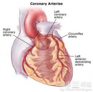 有冠心病怎麼辦？