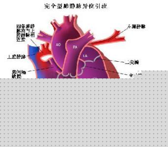 怎樣治療心肌病