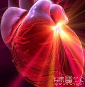 心絞痛的症狀有哪些