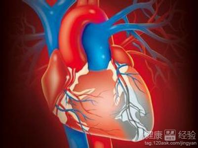 心絞痛症狀吃什麼藥