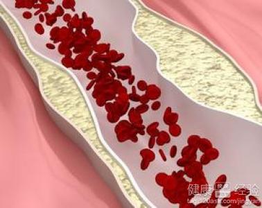 治療心絞痛的藥物