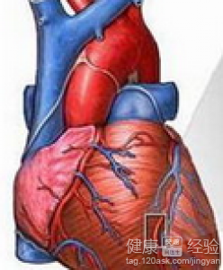 勞累性心絞痛嚴重嗎