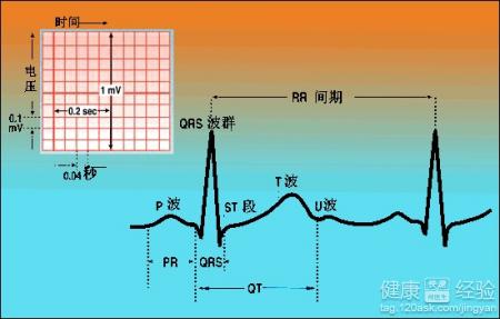早搏會導致心律失常嗎
