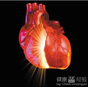 心絞痛平日裡要注意什麼？