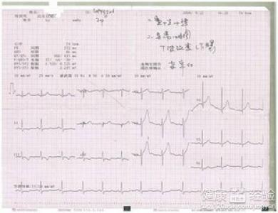 射頻消融治療心律失常有無生命危險