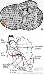 室性心律失常如何治療