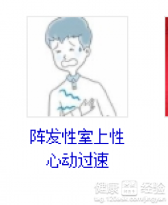心律失常中成藥治療效果好嗎