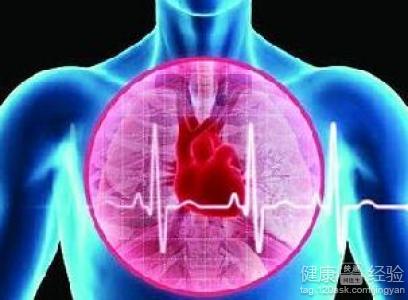 心律失常要如何預防