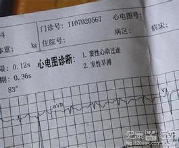 心髒早搏的治療須注意情緒!