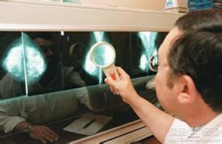 忽然出現早搏是怎麼回事