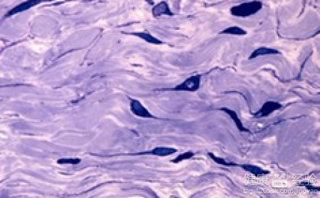 心律失常窦性停博是否要裝起博器