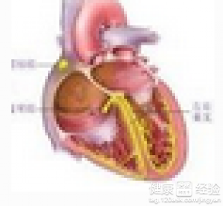 頻發室性早搏是否需住院治療