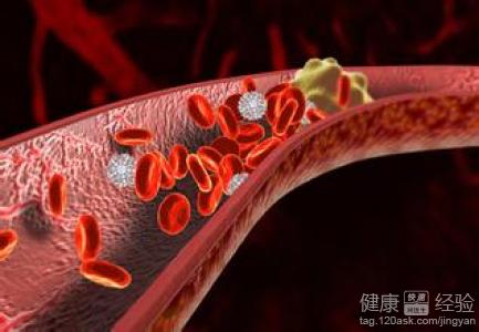 股骨骨折鋼板內固定術後合並深靜脈血栓怎麼辦