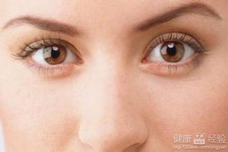 眼球靜脈血栓怎麼辦