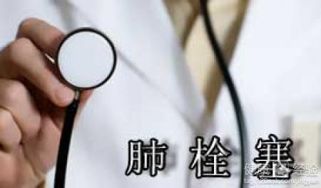 肺動脈栓塞嚴重嗎