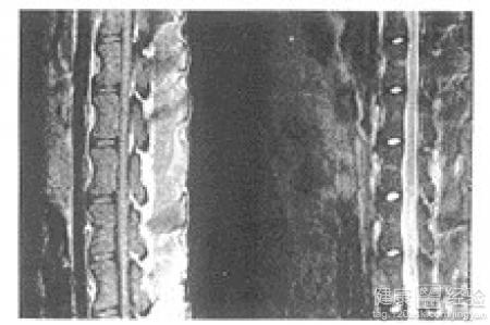 不要讓煙瘾傷害你的健康