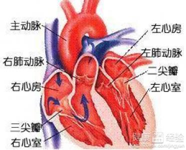 急性心肌梗死的分類