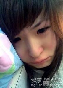 導致心肌梗死的原因