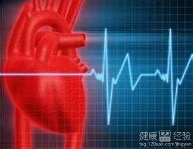 心肌梗死的治療方案