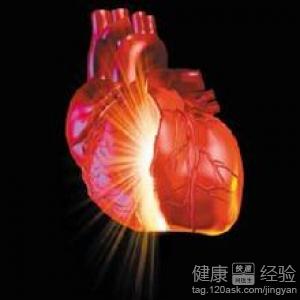 是什麼導致心肌梗死