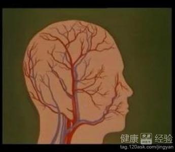 心肌梗死有什麼好的治療方法
