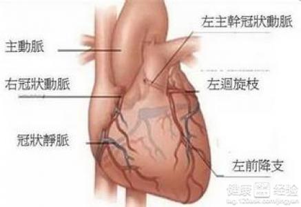 沉積性心肌梗塞是種什麼病啊