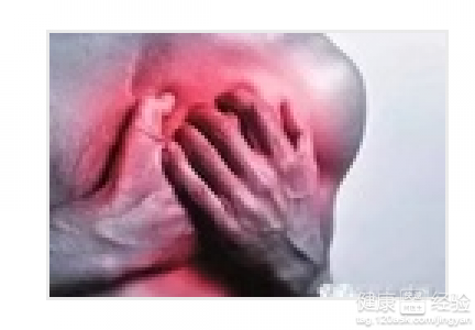 怎麼檢查是否患有心肌梗塞