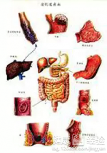 肺不張和心肌梗塞怎麼治療